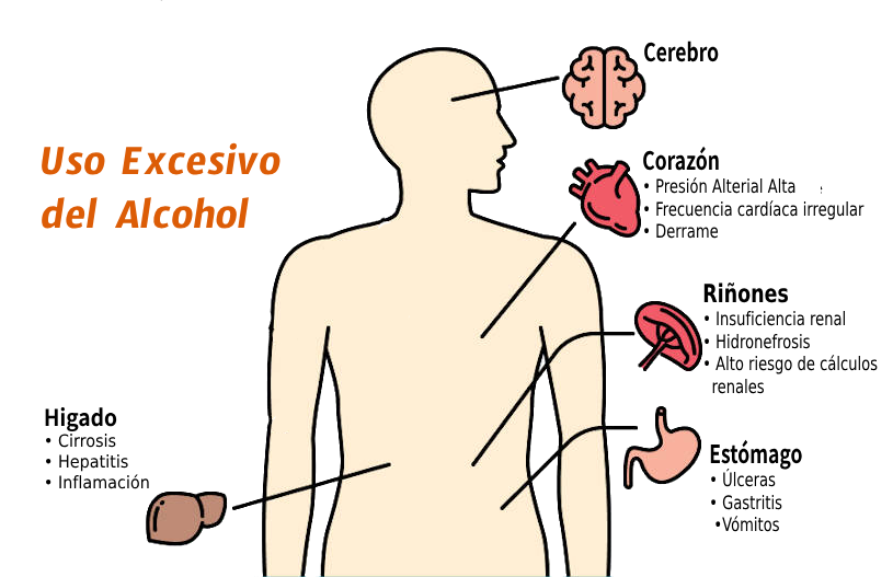 La figura del cuerpo humano con las partes afectadas por el alcohol