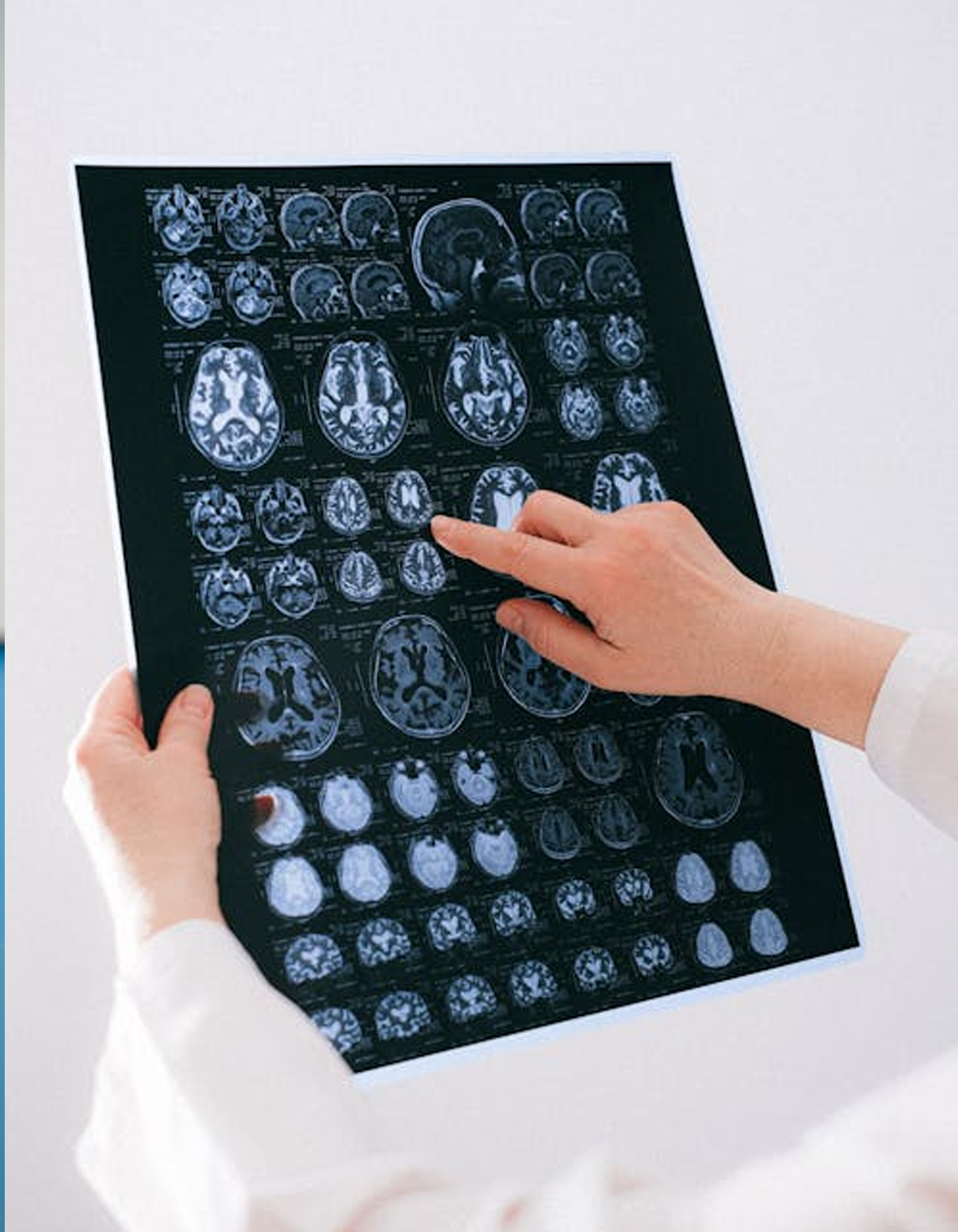 A doctor showing the results of a brain MRI